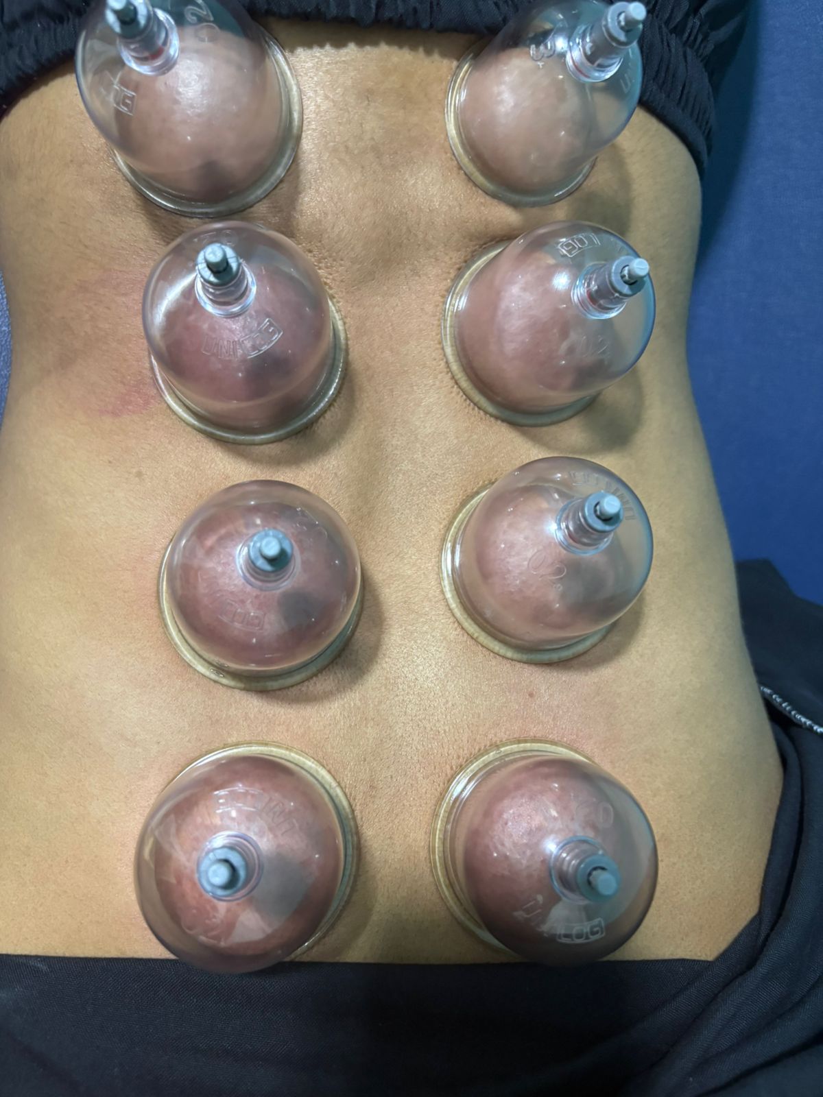 Cupping Course Image